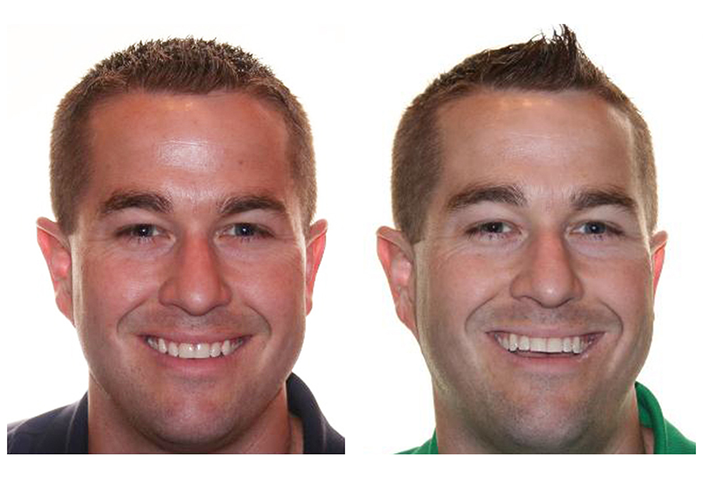 360 Dental of Mill Creek