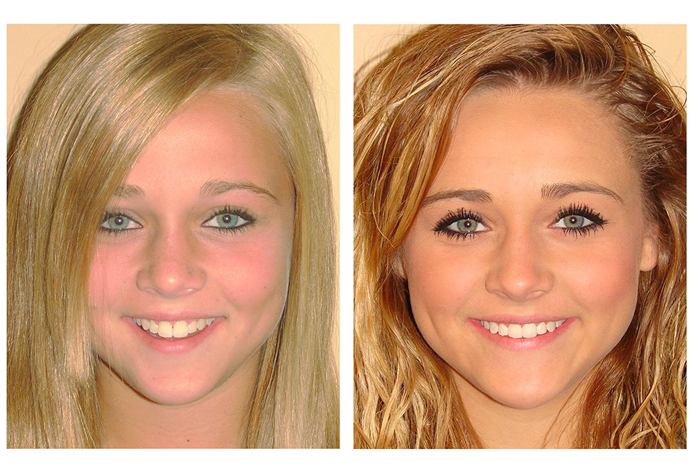 360 Dental of Mill Creek